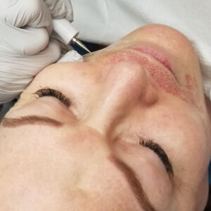 Curso PlasmaPen