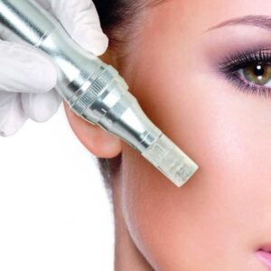Microneedling