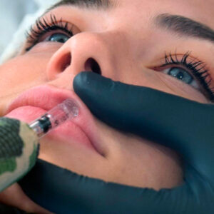 Curso Hyaluronic pen